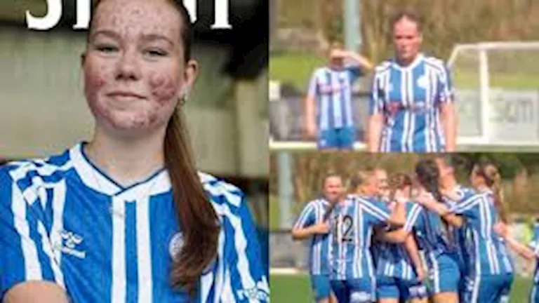 لاعبة تتعرض للتنمر بسبب "حب الشباب".. ودعم رياضي وسياسي 4 لاعبة تتعرض للتنمر بسبب "حب الشباب".. ودعم رياضي وسياسي